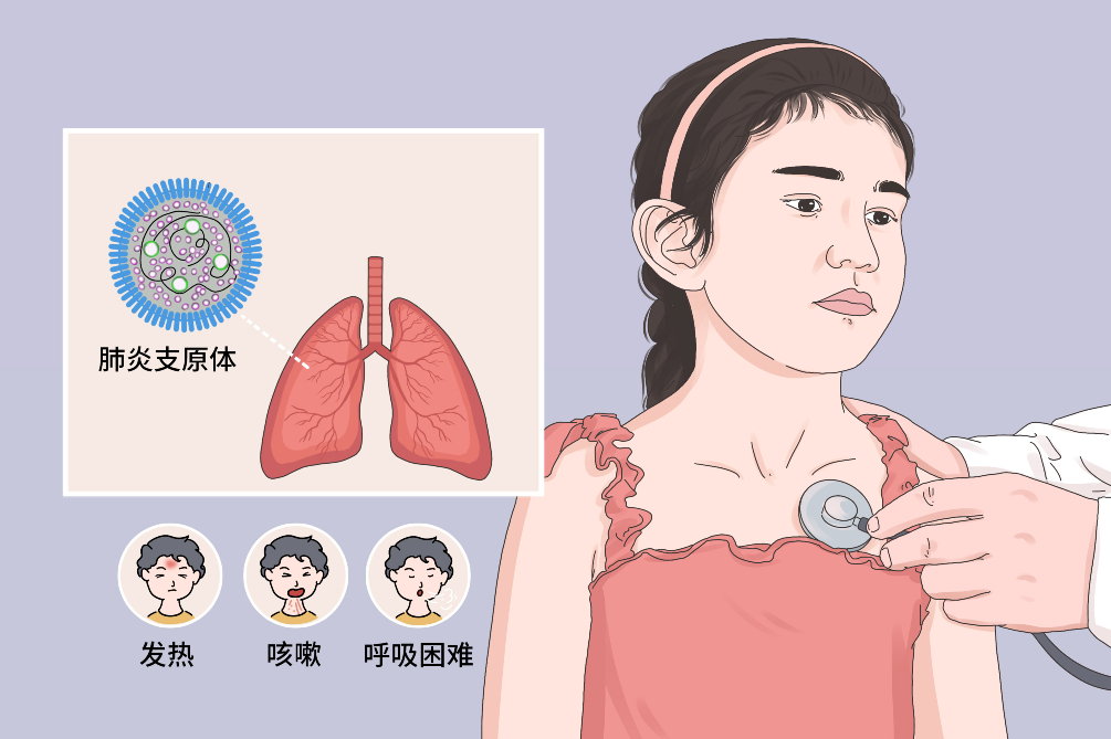 支原体肺炎早晚都咳嗽正常吗