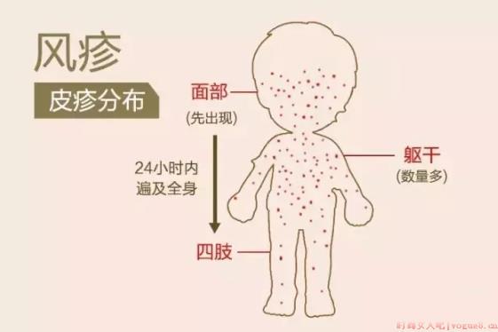 风疹疫苗孕前必须打吗 接种风疹疫苗后多久可以怀孕