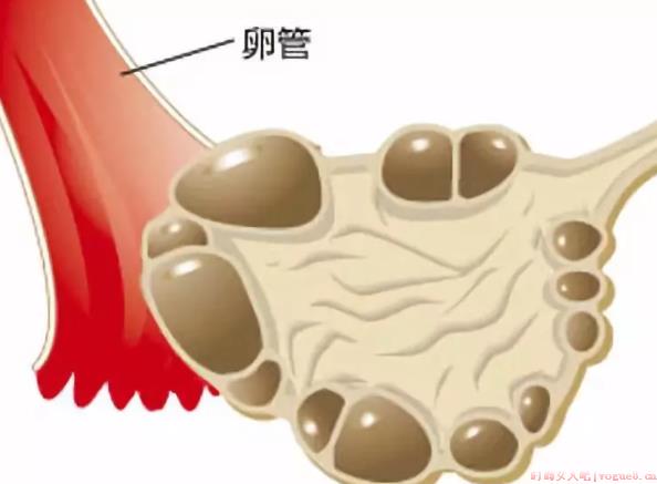 多囊患者可以自然排卵吗 多囊患者能自然怀孕吗