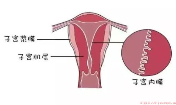 子宫内膜太薄会不孕吗 子宫内膜薄有哪些症状