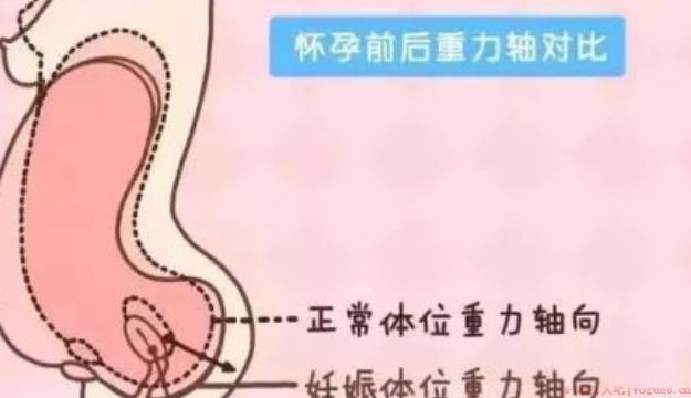 子宫偏小还能怀孕吗