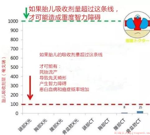 怀孕的时候拍了CT有影响吗