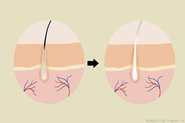 头发为什么会变白？年轻人长白发暗示了什么？白发可以拔掉吗？