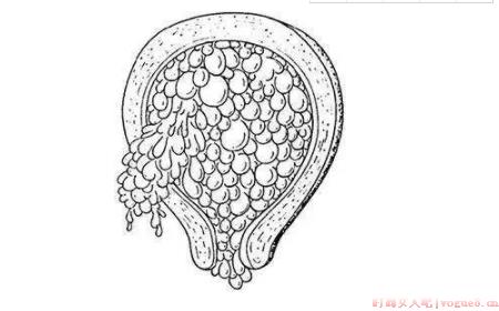 葡萄胎两年内不能怀孕吗 葡萄胎后能正常怀孕吗