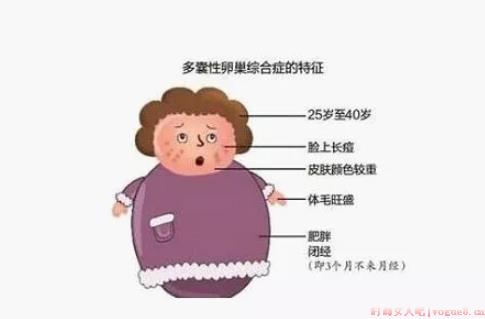 刚出月子来例假是易孕体质吗