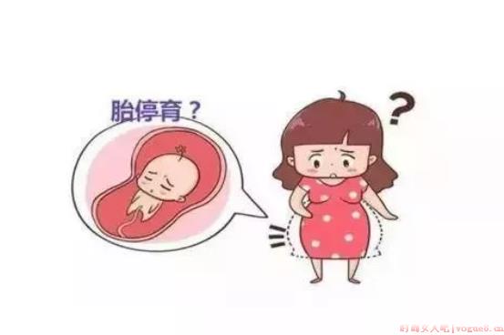 孕期需要反复检查孕酮吗