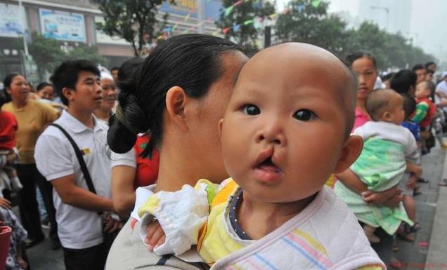 孕妇吃兔肉会生兔唇宝宝吗